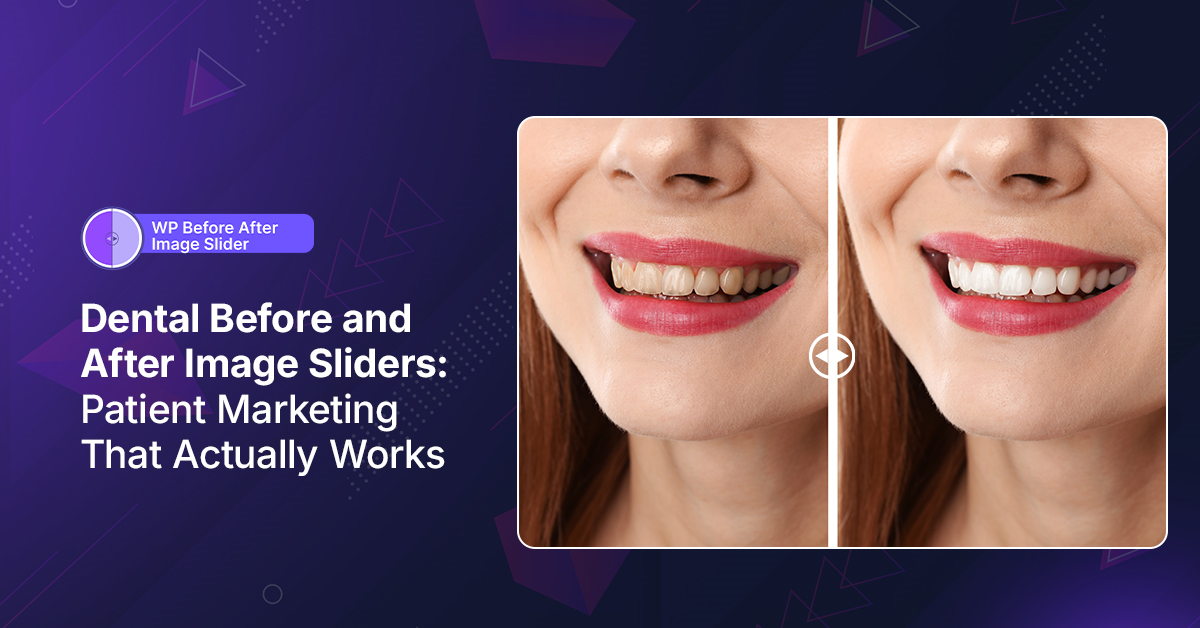 Dental Before and After Image Sliders: Patient Marketing That Actually Works